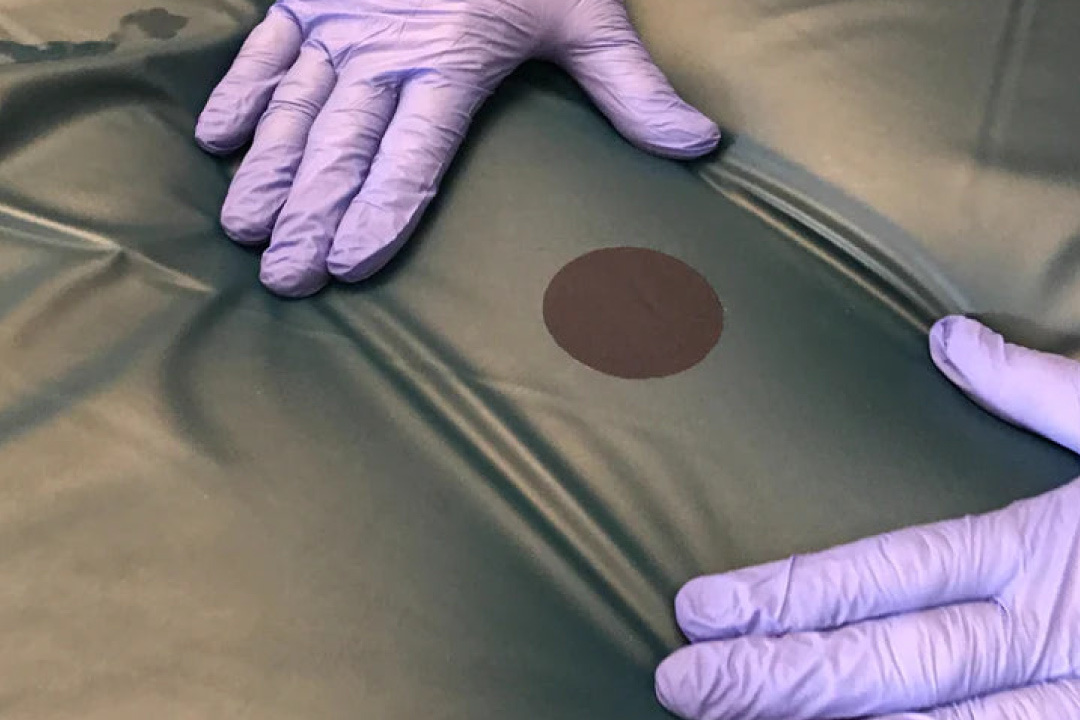 CleanPatch repair patch on hospital bed
